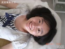 -美丽人生祛斑扁平疣汗管瘤中心