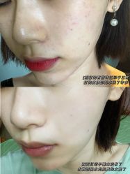 -慕颜医疗美容·皮肤微整 抗衰