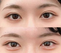 -比华利美容医院