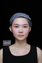 -深圳阳光医疗美容医院·旗舰店