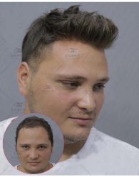 -发饰美男士增发补发假发定制店