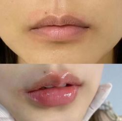 -美莱医疗美容医院