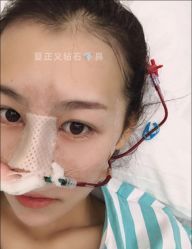 -北京米扬丽格医疗美容·联合丽格鼻整形中心