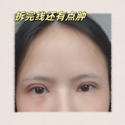 -素美医疗美容·西南眼鼻整形·修复基地