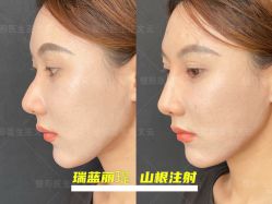 -北京米扬丽格医疗美容·联合丽格鼻整形中心