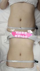 -Lily纤美·科技减脂中心