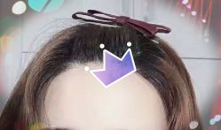 -大麦微针植发全国连锁