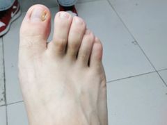 -新甲连锁灰指甲·甲沟炎·鸡眼(黑龙江路店)