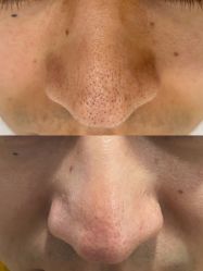 -初樱科技美学问题肌修复中心