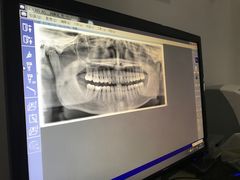 拍的x光照-德伦口腔