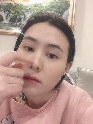 -成都西区医院整形美容