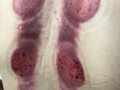 -灸春堂·艾灸·痛症·整脊连锁(之江银泰店)