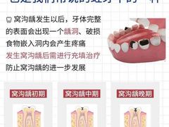 -上海仁爱医院口腔科 · 种植