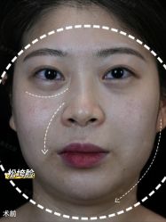 -Yestar重庆艺星医疗美容医院