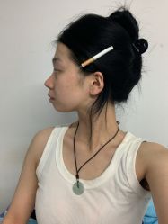 -四川米兰柏羽医学美容医院