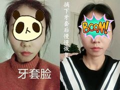 -团圆口腔·种植中心(锦江院区)