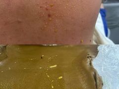 -莱仪堂艾灸经络养生馆(九亭一店)