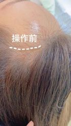 -MISS STAR·半永久纹眉·发际线·美瞳线