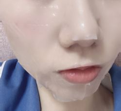 体验后-JUVA郑州欧华医疗美容医院