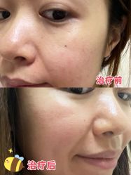 -慕颜医疗美容·皮肤微整 抗衰