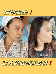 -八大处整形