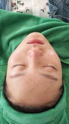 -苗方清颜·祛痘皮肤管理