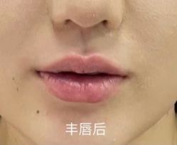 -东剑医学美容·注射美学中心