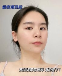 -慕颜医疗美容·皮肤微整 抗衰