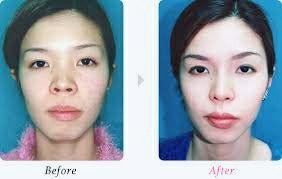-SKINIST丽铂医疗美容