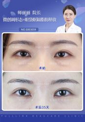 -丰联丽格医疗美容·联合丽格眼整形中心