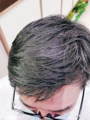 点击看大图 -新生植发·植养护一体