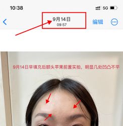 体验后-深圳阳光医疗美容医院·旗舰店