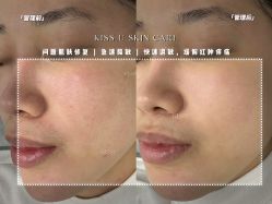 -KISS U 国际美学