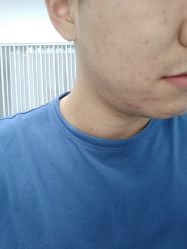 -肤原祛痘·科技修肤中心