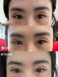 -八大处整形