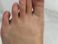 -Andrew指甲专科灰指甲·甲沟炎矫正·3D步态矫形鞋垫定制(浦三路店)