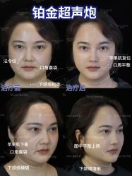 -Yestar重庆艺星医疗美容医院