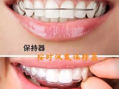 -团圆口腔·种植中心(锦江院区)