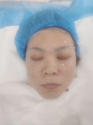 点击看大图 体验后-坤如玛丽·医疗美容中心