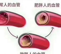 -香薇妮丝·定制减肥·身材管理