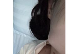 -蚌埠国色医疗美容医院•眼鼻整形