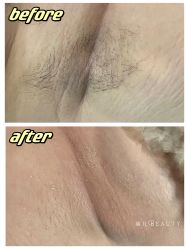 -植蔻妍倍儿专业脱毛·皮肤管理