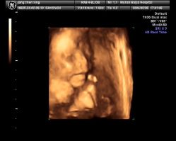 -武汉百佳妇产医院