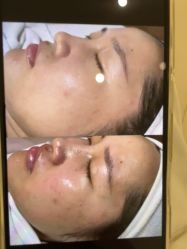 点击看大图 -蕾特恩专业祛痘·皮肤管理