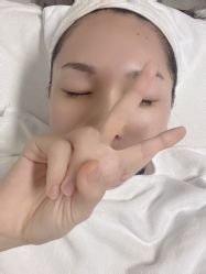 -佳慕·痘痘·问题肌管理中心