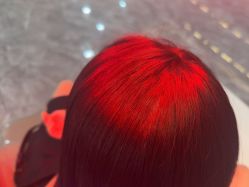 -碧莲盛·不剃发植发