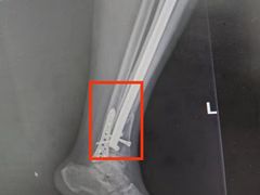 -上海市第一人民医院(松江南部)