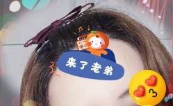 -大麦微针植发全国连锁