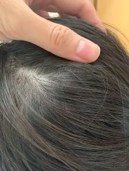 -熙朵美学植发·连锁品牌