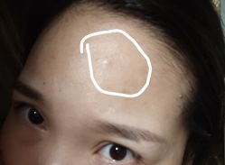 -悟空祛痘·诺奖技术专业店